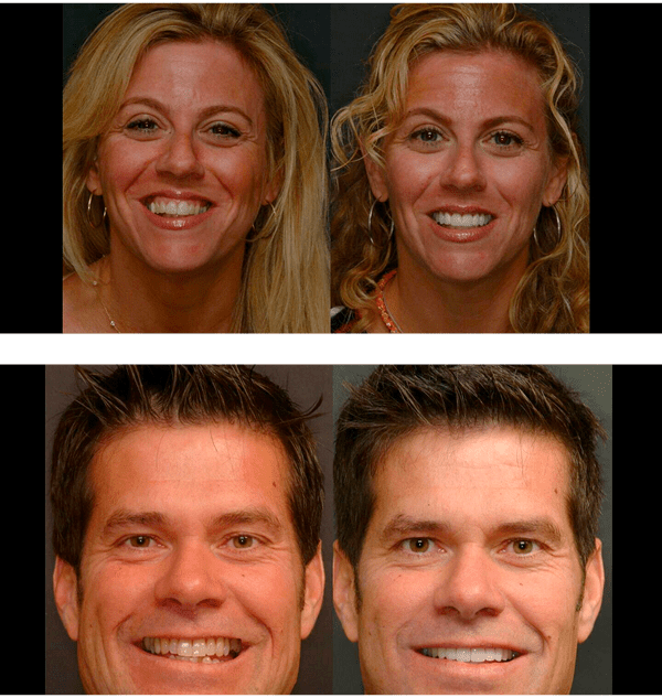Smiles highlighting dental work results